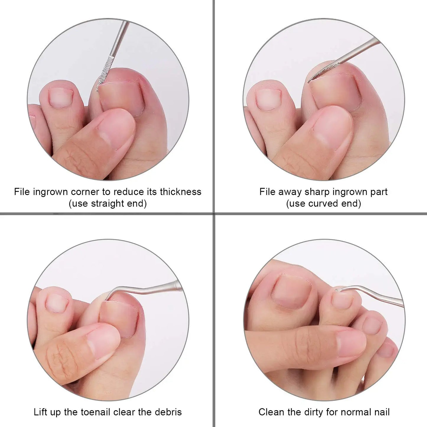 Coupe-ongles pour orteils incarnés ou épais, coupe-ongles professionnel pour podologue, pince à ongles avec Supe en acier inoxydable